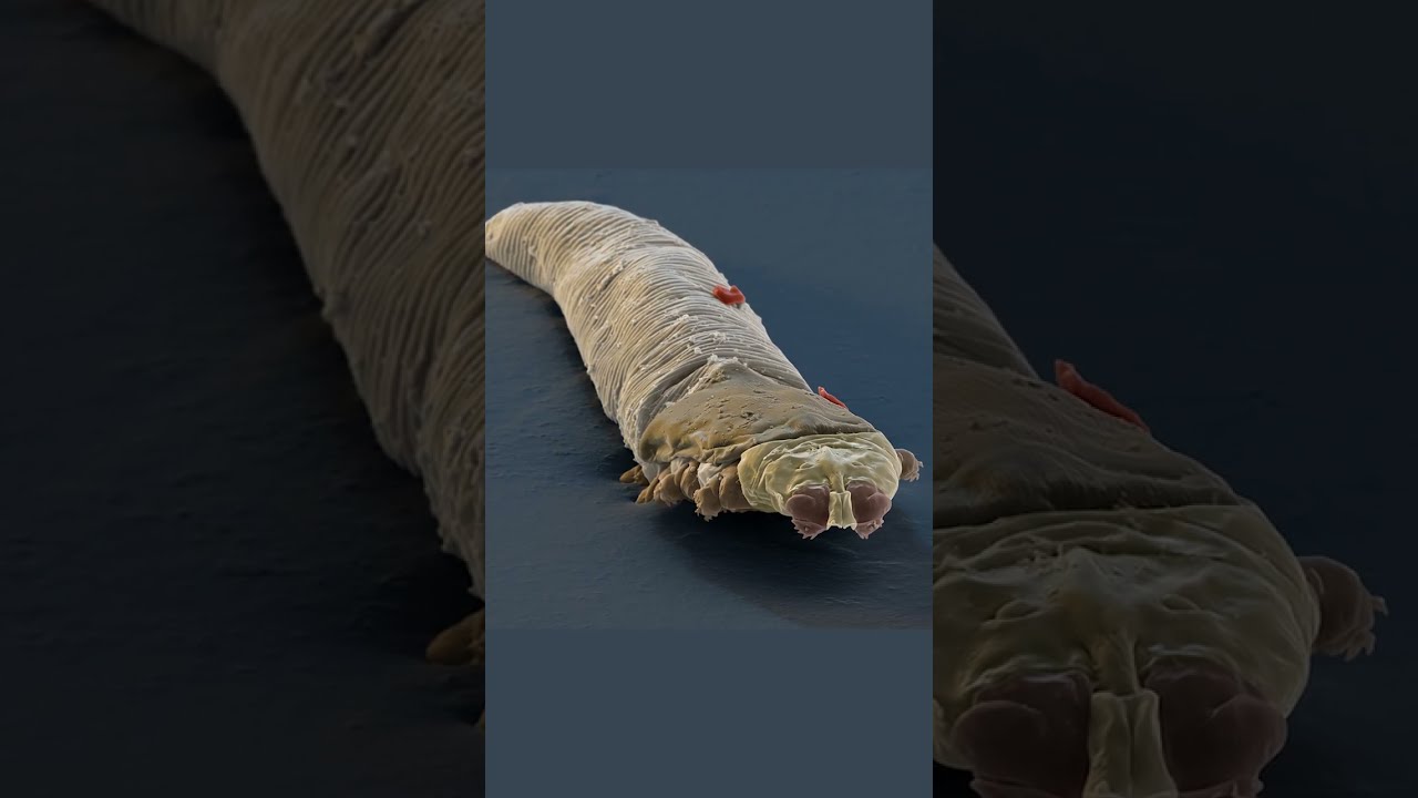 Этот Клещ живет на твоих ресницах - YouTube