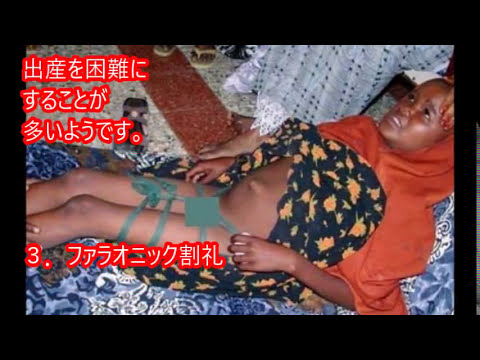 【閲覧注意】女の子の割礼！？あまりの痛々しさに驚愕…