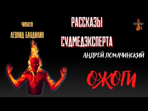 Рассказы Судмедэксперта: ОЖОГИ (автор: Андрей Ломачинский).