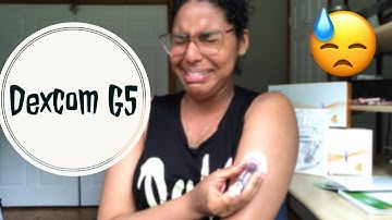 Dexcom G5: First Insertion | Hungry Diabetic