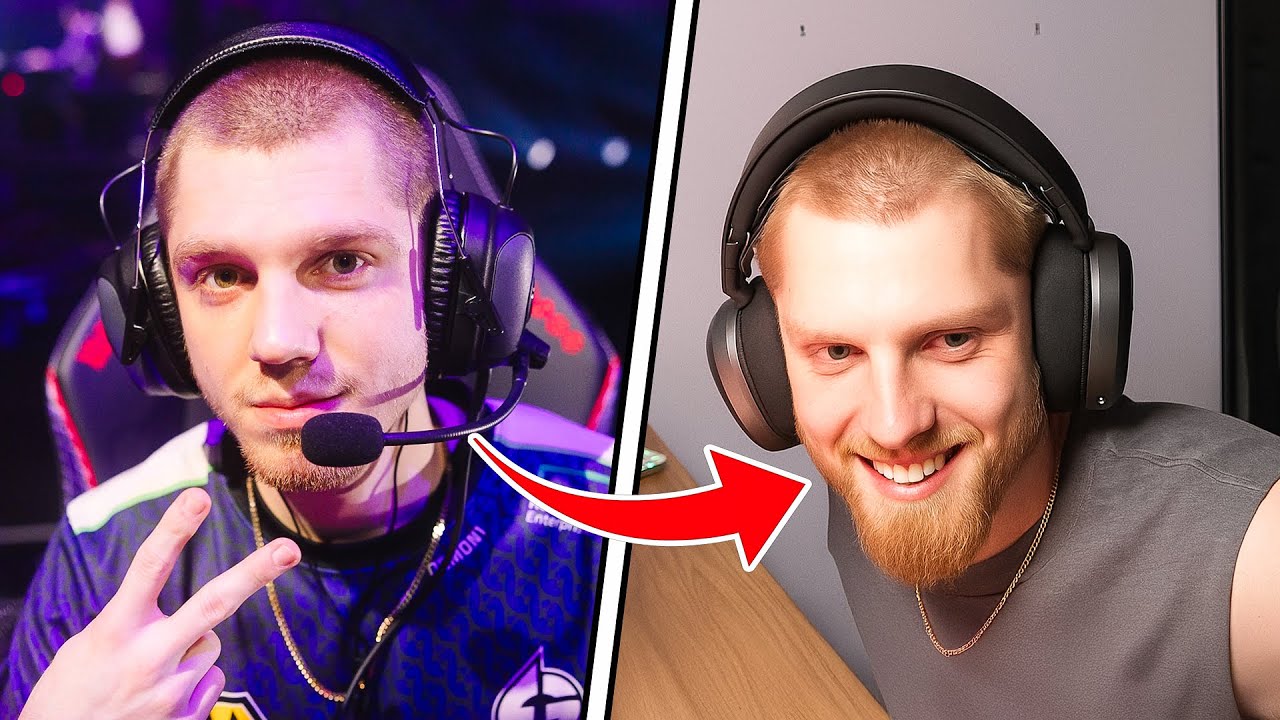 The Demon1 Bald Buff is back