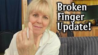 Healing From A Broken Finger And Surgery
