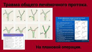 Травма общего печеночного протока.  При плановой операции