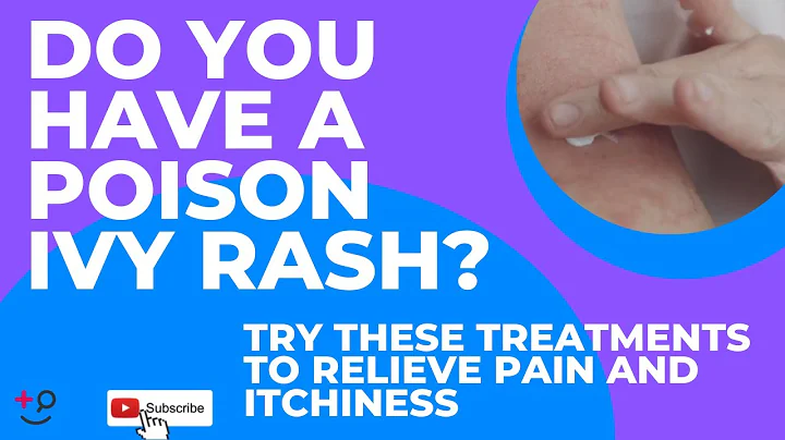 Poison Ivy Rash? Try These Helpful Treatments to Relieve Pain and Itchiness