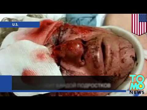 Группа подростков жестоко избила пожилого мужчину из Балтимора балтимор погода