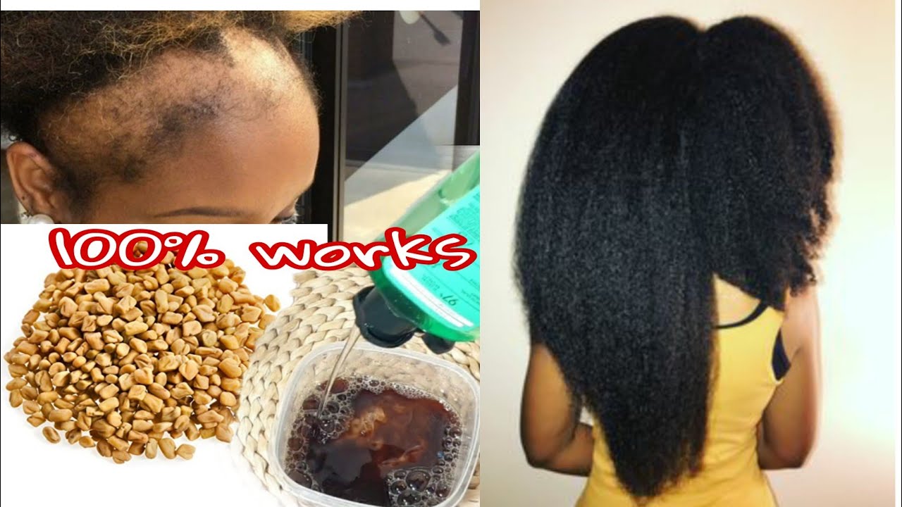 put this ingredients in your shampoo it speeds up Hair Growth 🌱 Natural