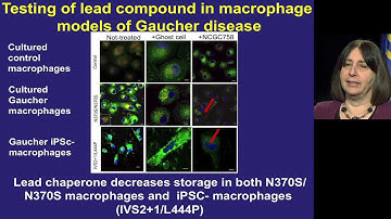 IRP Neuroscience Webinar (Part 2) - Ellen Sidransky, NIH Scientist