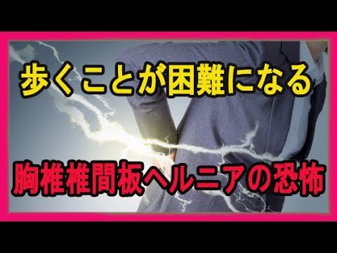 歩くことが困難になる 胸椎椎間板ヘルニアの原因と治療法 Youtube