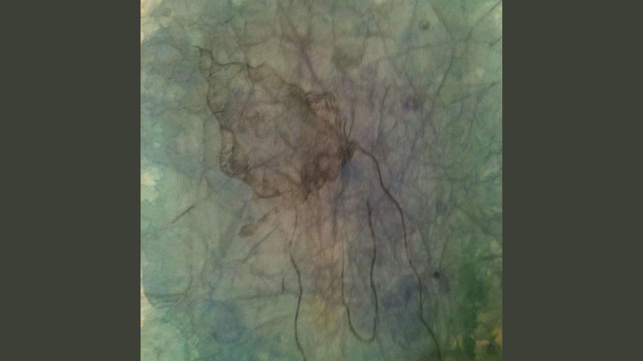 The Cost Is Not Worth It