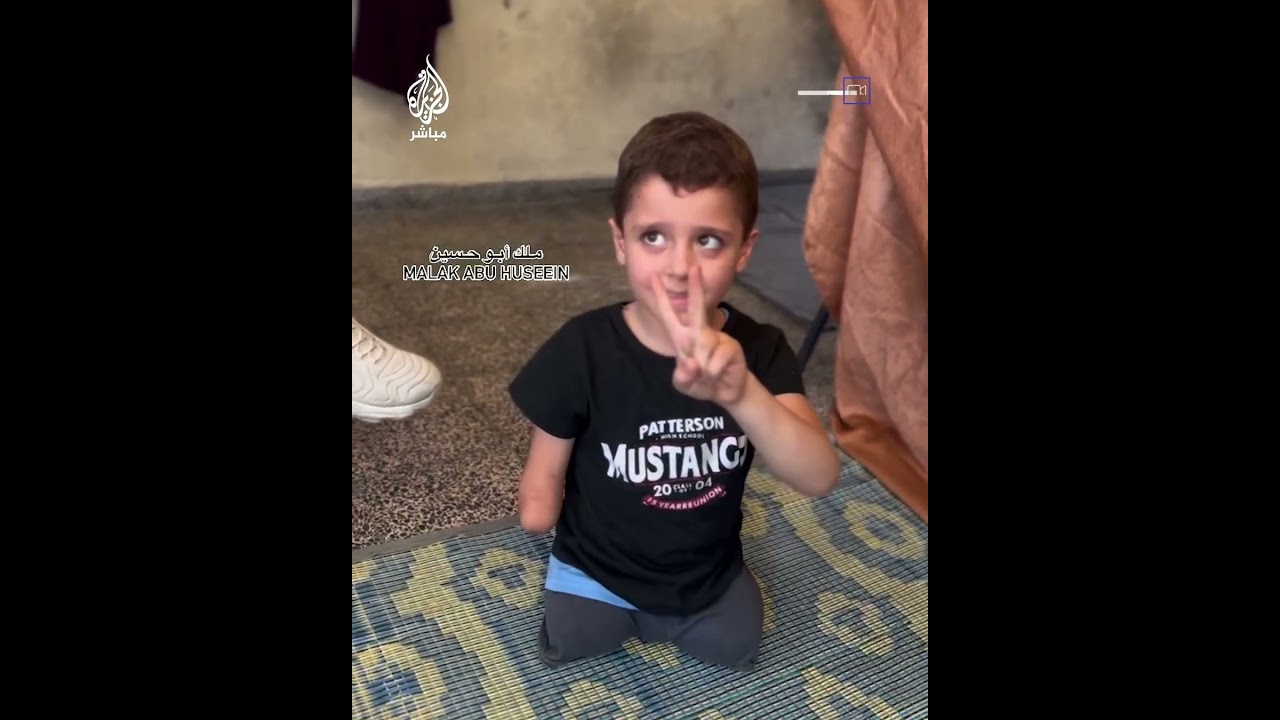 طفل فلسطيني يعيش بطرف واحد جراء إصابته من قصـ.ـف الاحتـلال