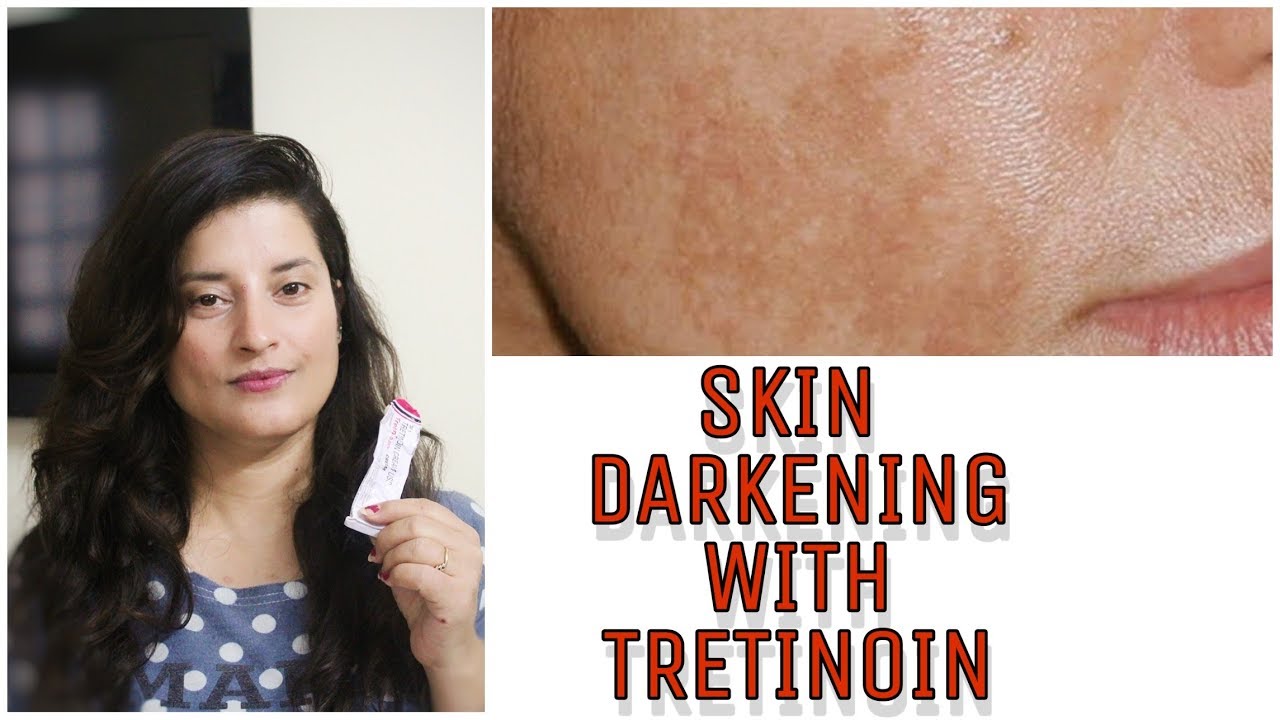 SIDE EFFECTS OF RETIN A SKIN DARKENING SKIN PURGING Peeling Rachna SIDE EFFECTS OF RETIN A SKIN DARKENING SKIN PURGING Peeling Rachna