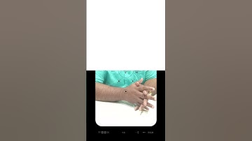 Google My Business Call Button Recovery