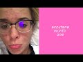 accutane month one | formerly: ASPENLIKEATREE