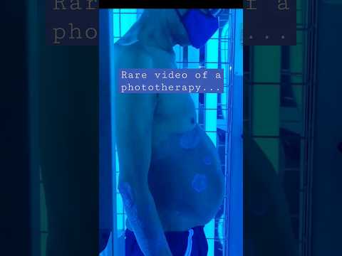 Light Cubicle UVB Phototherapy For Psoriasis Shorts 