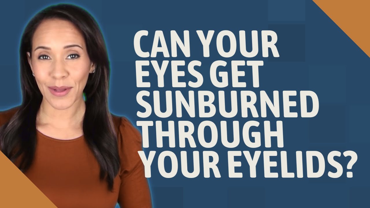 Can your eyes get sunburned through your eyelids? YouTube