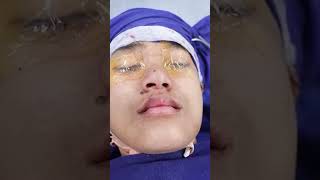 Indian Girls Surgical Face Transformation