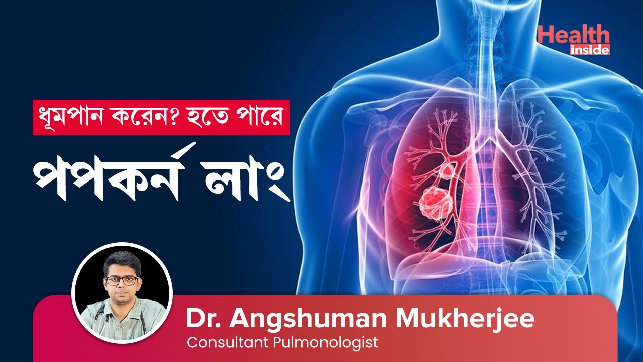 পপকর্ন লাং কি? কেন হয় ও চিকিৎসা কি? What is Popcorn Lung Its causes and treatment YouTube
