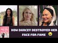Darcey and Stacey - How Darcey Destroyed Her Face for Fame