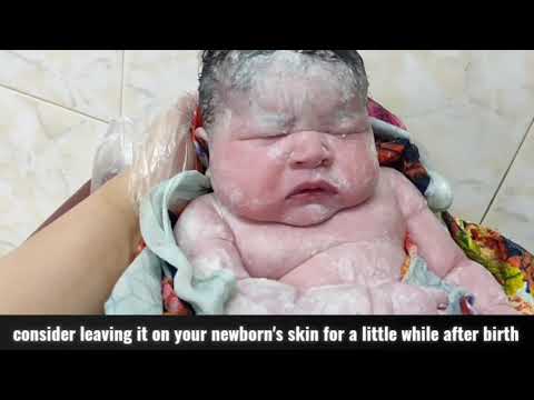 Vernix caseosa ,White matter on newborn baby body #vernix #body #cute #life #newborn #love #birth