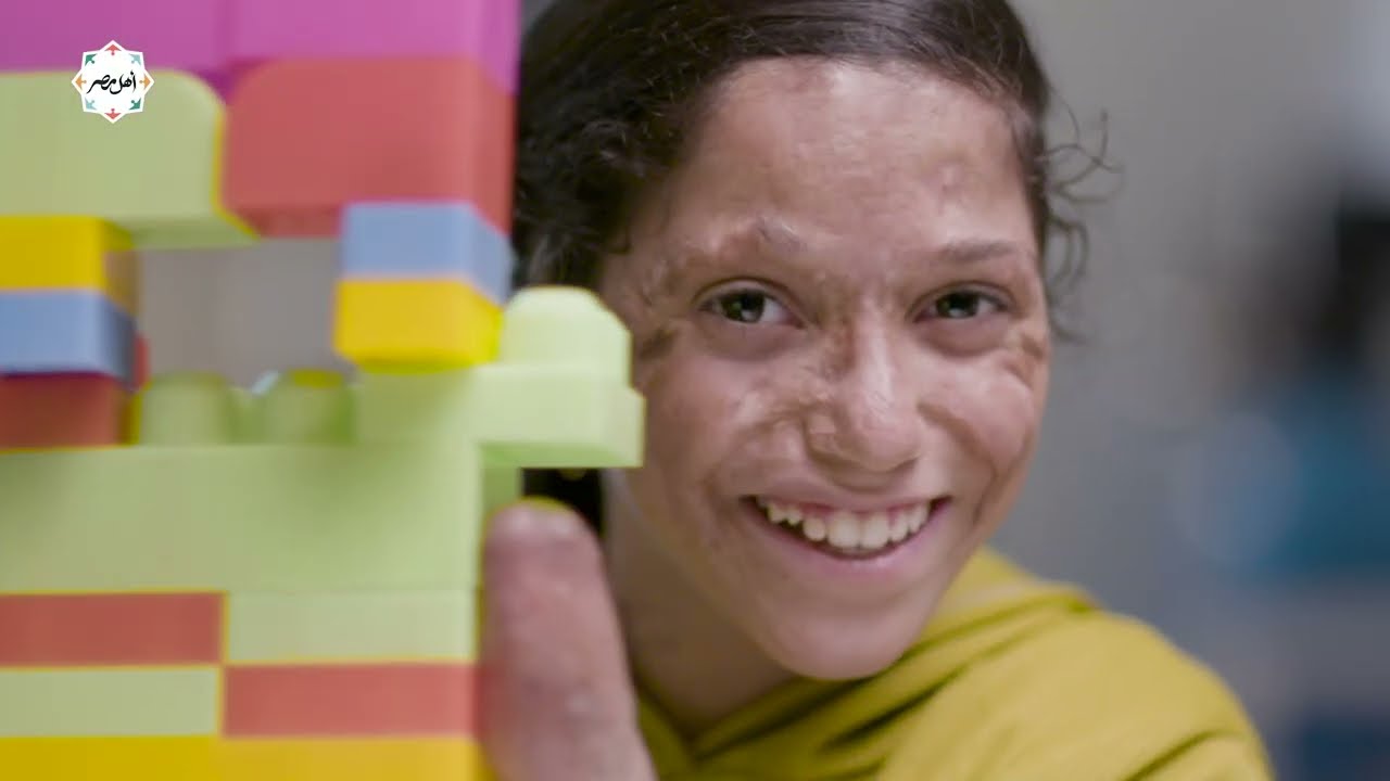 حكاية أمل | الفيلم الوثائقي لـ مستشفى أهل مصر للحروق