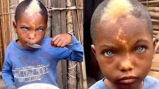 Unique Kids With Unusual Super Powers: His Eyes Can Heal People?