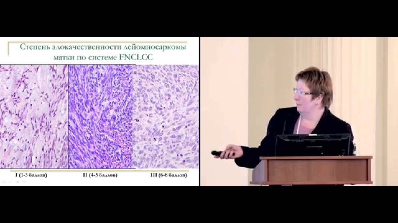 Биология сарком и особенности их гистологических вариантов
