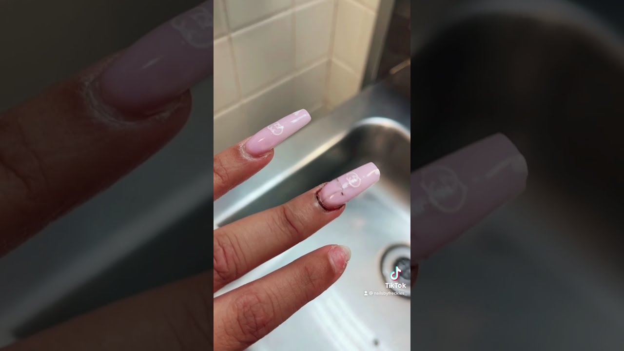 Ripped My Nail Off