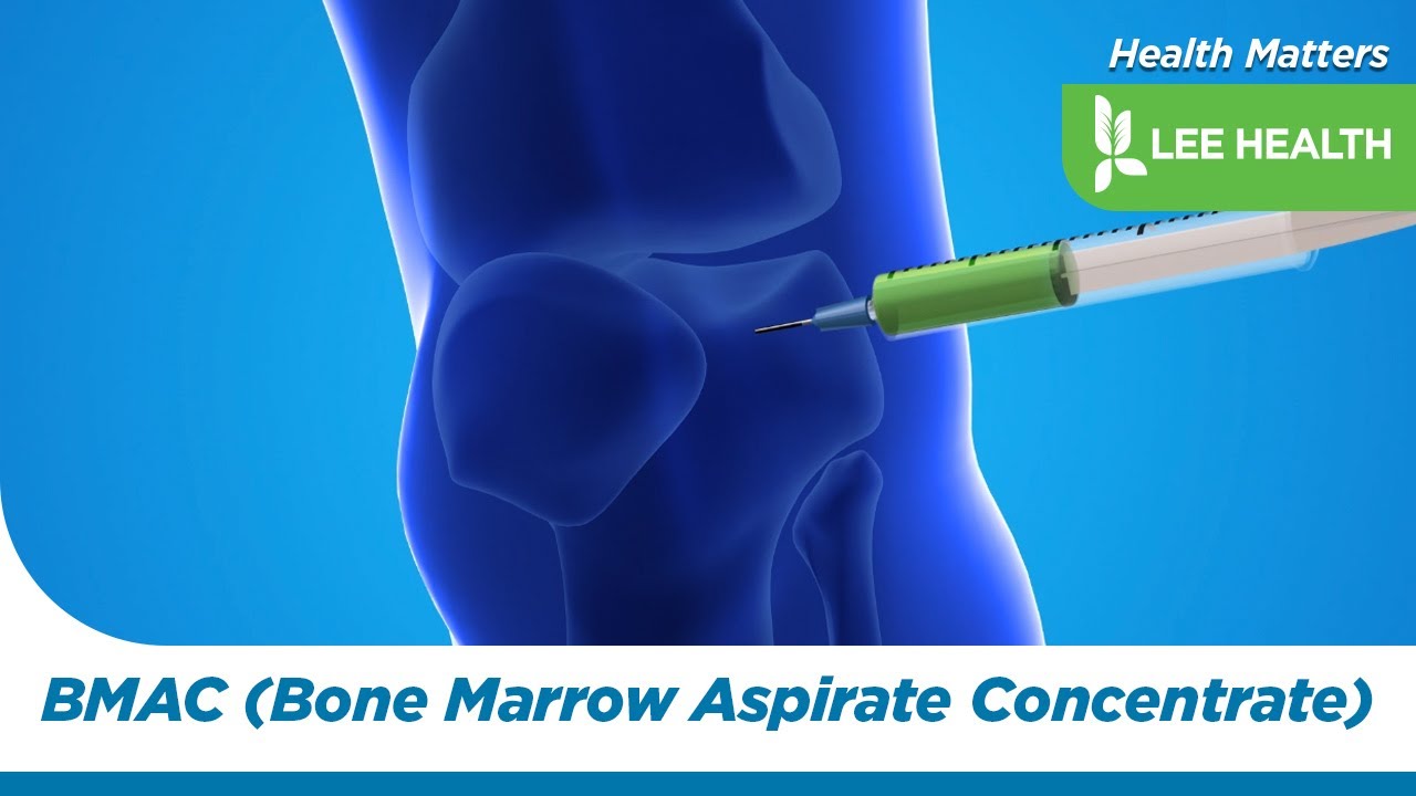 BMAC (Bone Marrow Aspirate Concentrate) - YouTube