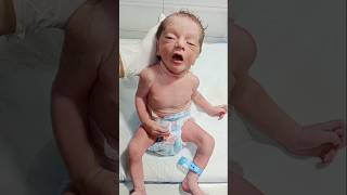 Low Birth Weight Baby In Nicu Observation Care & Good Reflex Moment