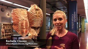 Fascial Net Plastination Project: Abdominal Superfical Fascia with RACHELLE L. CLAUSON