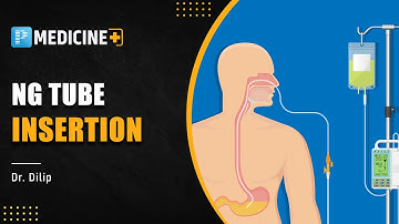 Nasogastric Tube Insertion by Dr. Dilip | PrepLadder NEET SS