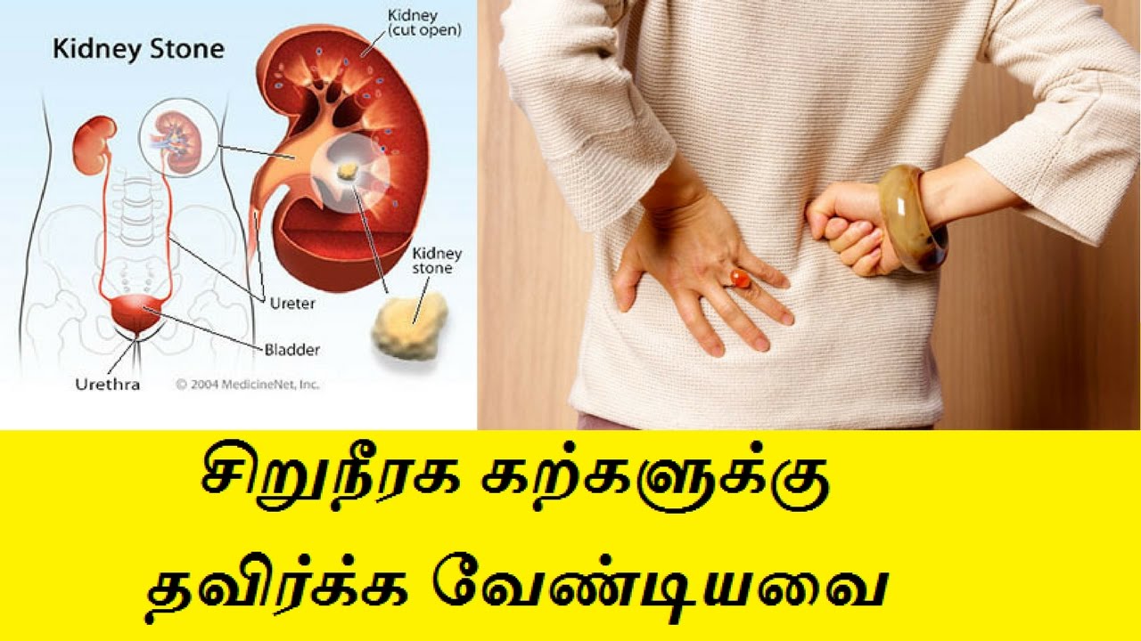 Renal Calculi Diet Chart