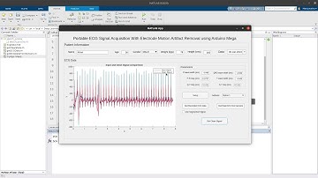 Portable ECG Signal Acquisition With Electrode Motion Artifact Removal using Arduino
