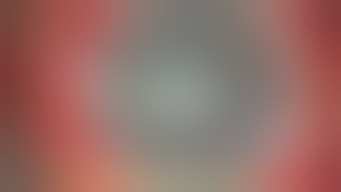 Iris IOL scaffold with sub flap vitrectomy Soosan Jacob