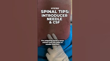 Spinal tips: Introducer, needle & CSF #spinal #anesthesia  #regionalanesthesia #nysora