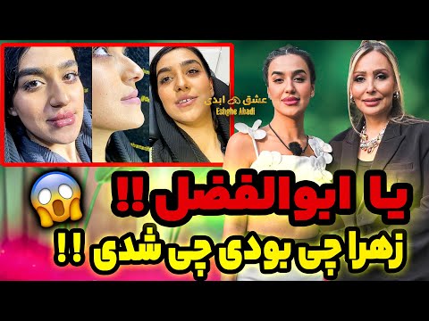 وااای قیافه زهرا عشق ابدی قبل از رفتنش از ایران شوکه شدم  