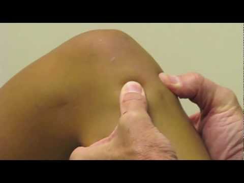 ACL Exam Lachman's Test, Pivot Shift, Drawer Test performed by Dr. Eric Janssen