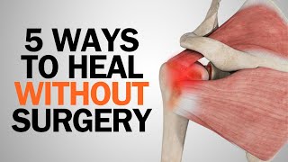 5 Natural Ways To Rehab At Home After A Rotator Cuff Tear