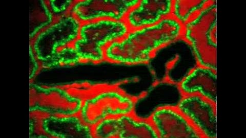 #NIDCR: Filtration of a Fluorescent Dye Through the Kidney of a Live Rat