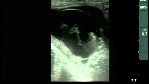 Cow #4539 Day 55 of Gestation