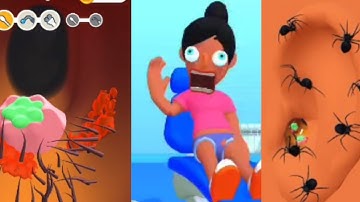 EarWax Clinic Game 3D New Max Level Gameplay Walkthrough Update Trailer iOS, Android Mobile Game