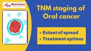 TNM staging of oral cancer l Oral surgery l Mediklaas by Mediklaas 8,498 views 3 years ago 5 minutes, 27 seconds