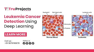 Leukemia Cancer Detection Using Deep Learning   best btech deep learning projects providers