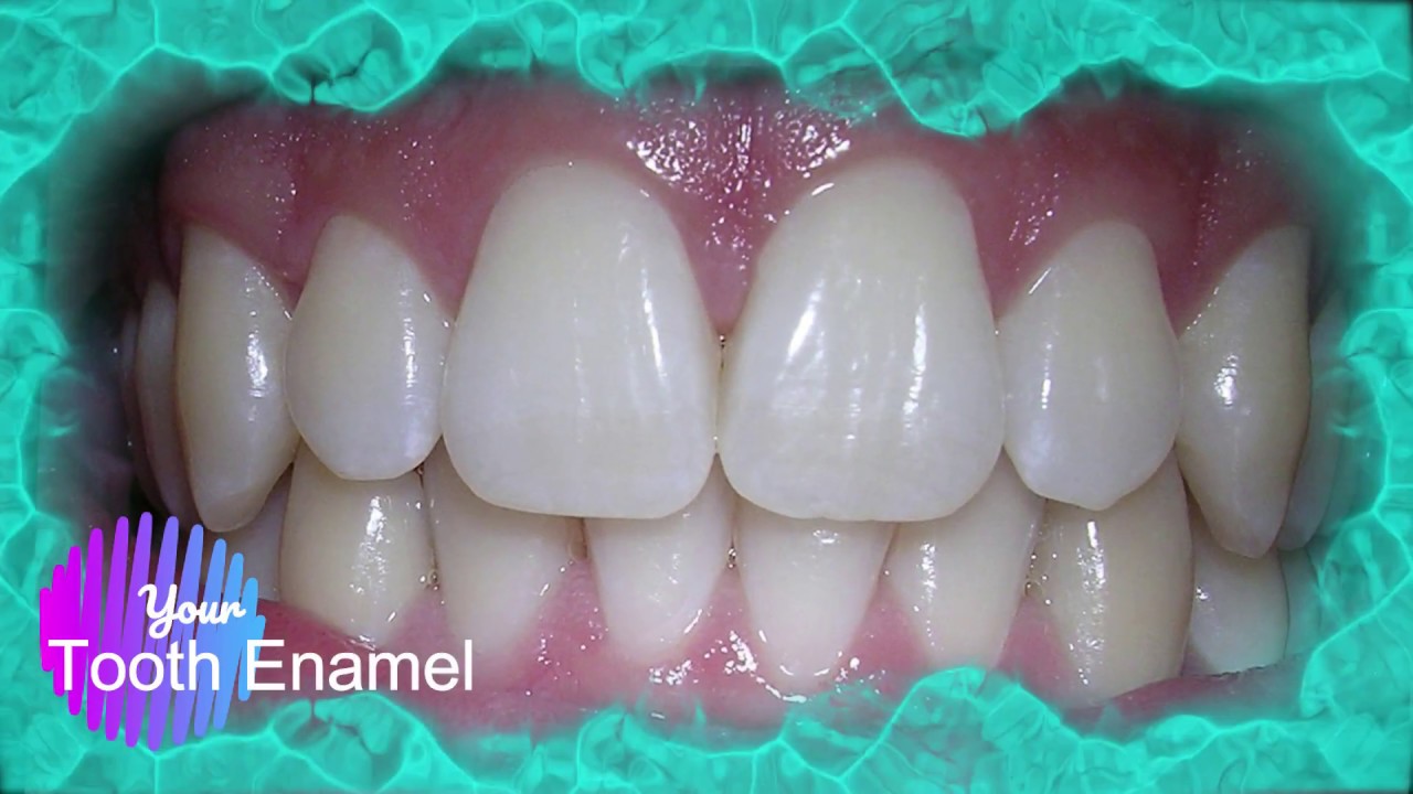 Prevention Of Decay, By Right tooth brushing. What You Do not Know About Brushing Your Teeth