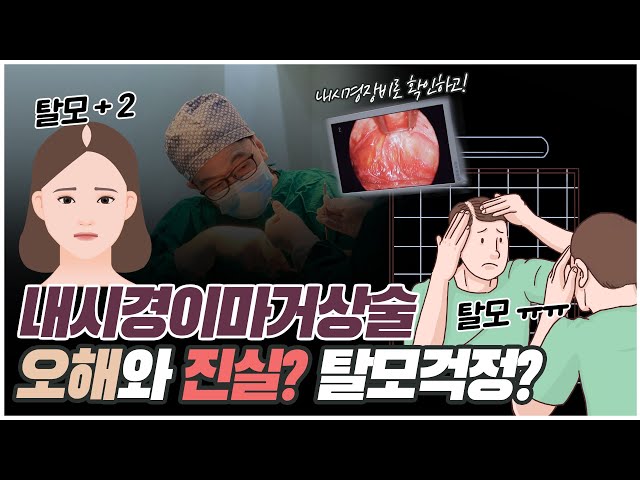 내시경이마거상술 오해와 진실? 탈모걱정? #내시경이마거상술