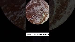 #GNETUM MALE CONE #botany #gnetum male cone #india #nature #microscope #microbiology #plantanatomy