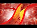 Arteriosklerose rückgängig machen: SO reinigst du deine Arterien ⚡️