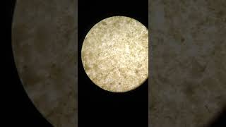 Microscopic view of Biofloc observed in our farm.