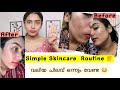 Vacation      10 steps   beginners simple skincare routine