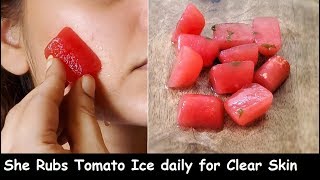 i Rub Tomato icecube Every Night & Removed Dark Spots, Got Crystal Clear GLASS Skin | Skin Whitening